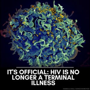 HIV